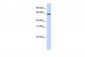 SLC33A1 antibody - middle region